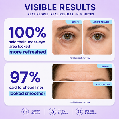 💧Instant Lift Eye Gel – Refreshes the Look of Puffiness, Dark Circles & Fine Lines